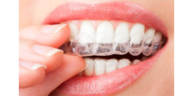 Белоснежные зубы без больших затрат и посещений стоматолога