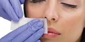 Волоски над губой – эффективные методы удаления